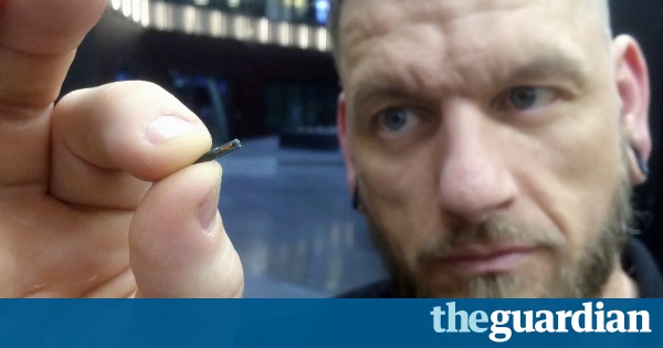Man with microchip